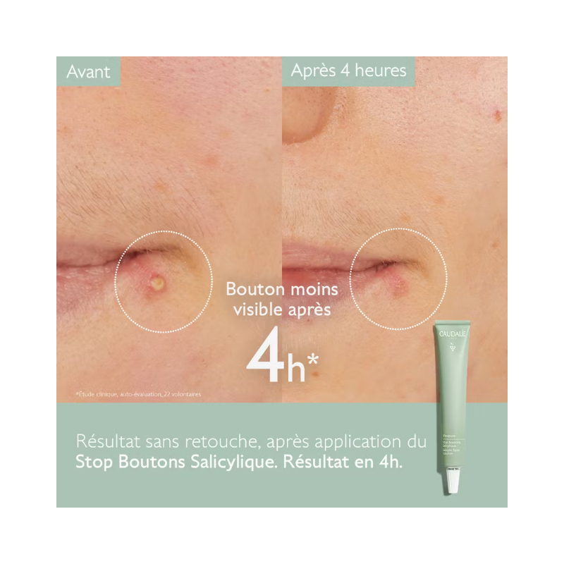 4 Crème Stop Boutons Caudalie